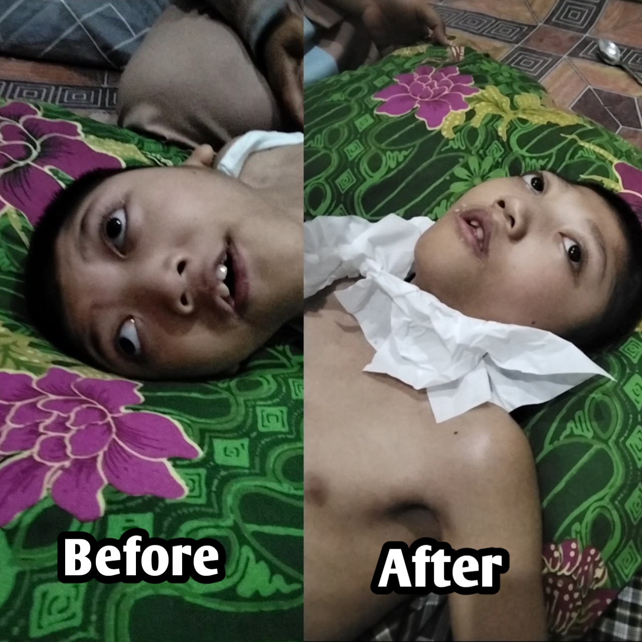 Therapist Syaraf Specialist Disabilitas