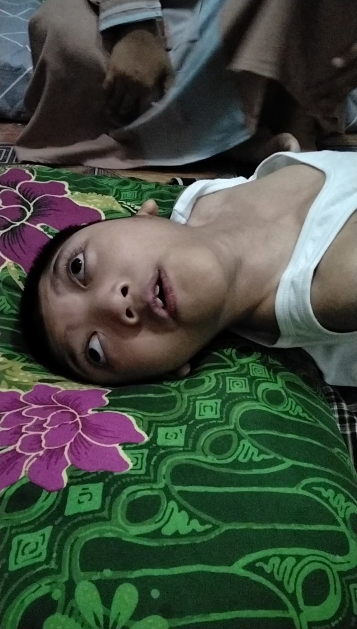 Therapist Syaraf Specialist Disabilitas