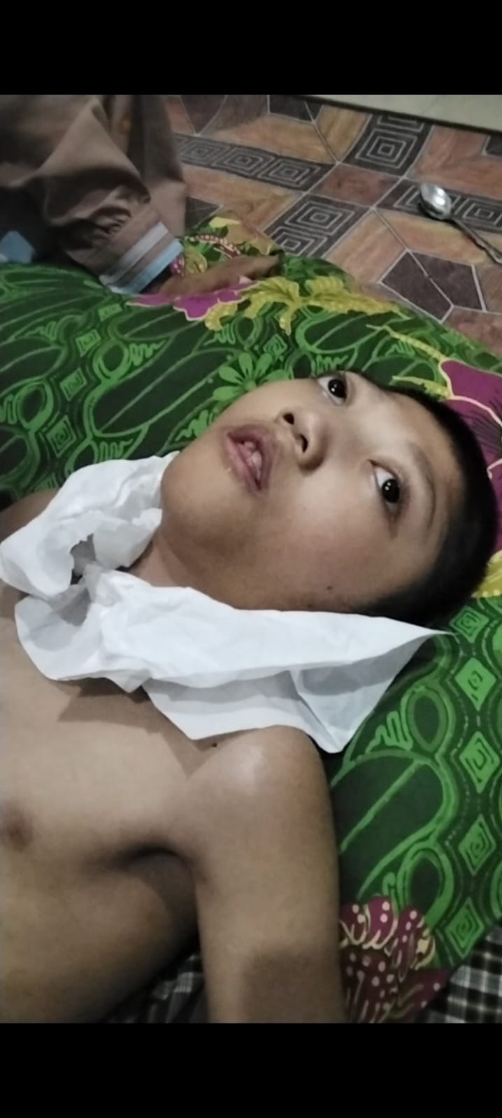 Therapist Syaraf Specialist Disabilitas