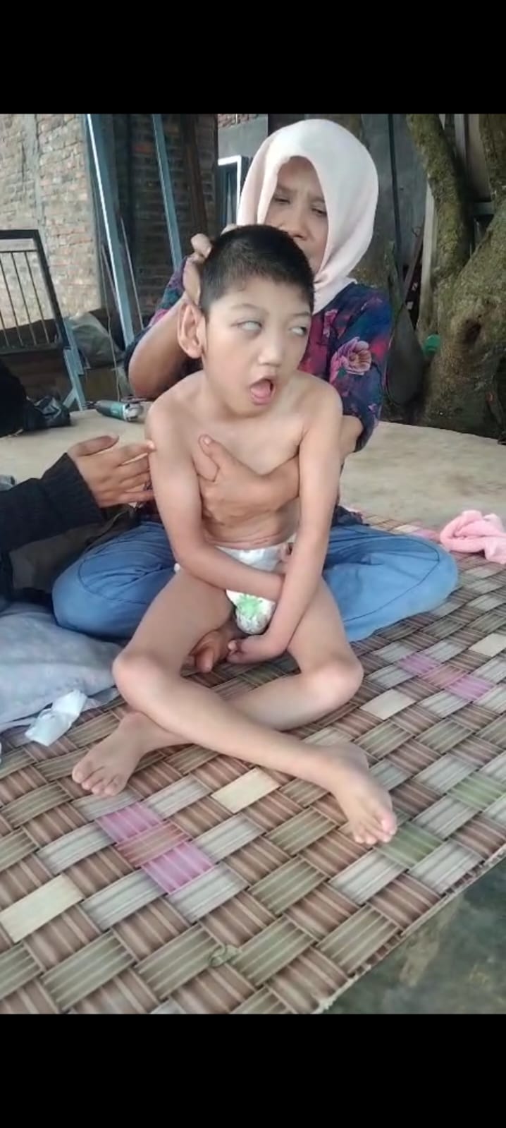 Therapist Syaraf Specialist Disabilitas